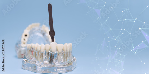 Obraz na płótnie dental shade guide comparing tooth color on an implant model, with a futuristic digital background representing dental technology advancements w salonie