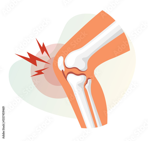 Knee Joint - Pain - Stock Illustration