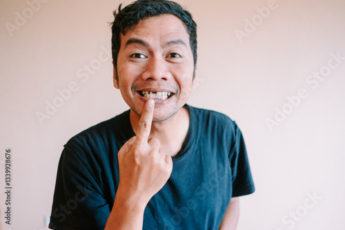 Man points to his missing teeth with a playful expression
