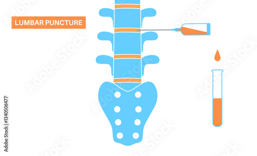 Lumbar puncture spinal tap