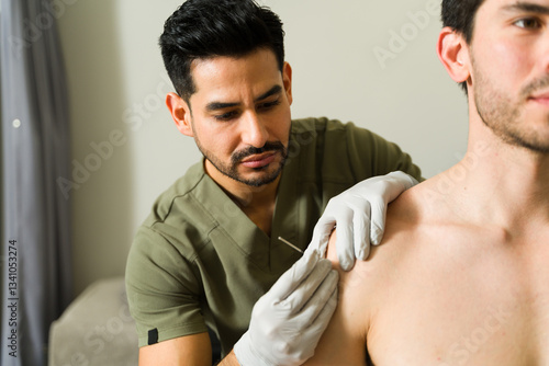Tableau sur toile Latin physiotherapist performing dry needling technique on male patient's should