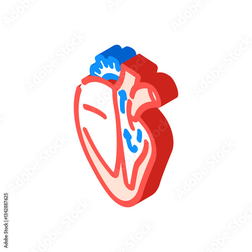 dilated cardiomyopathy cardiology disease isometric icon vector illustration