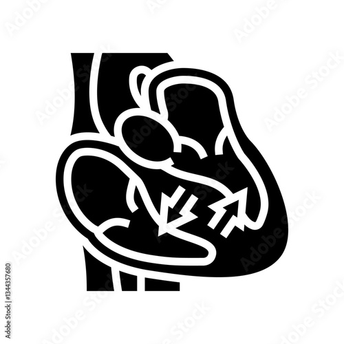 hypertrophic cardiomyopathy cardiology glyph icon vector illustration