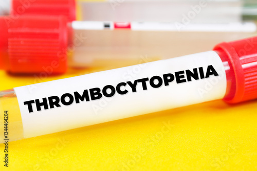 Wallpaper Mural thrombocytopenia text meaning analysis Torontodigital.ca