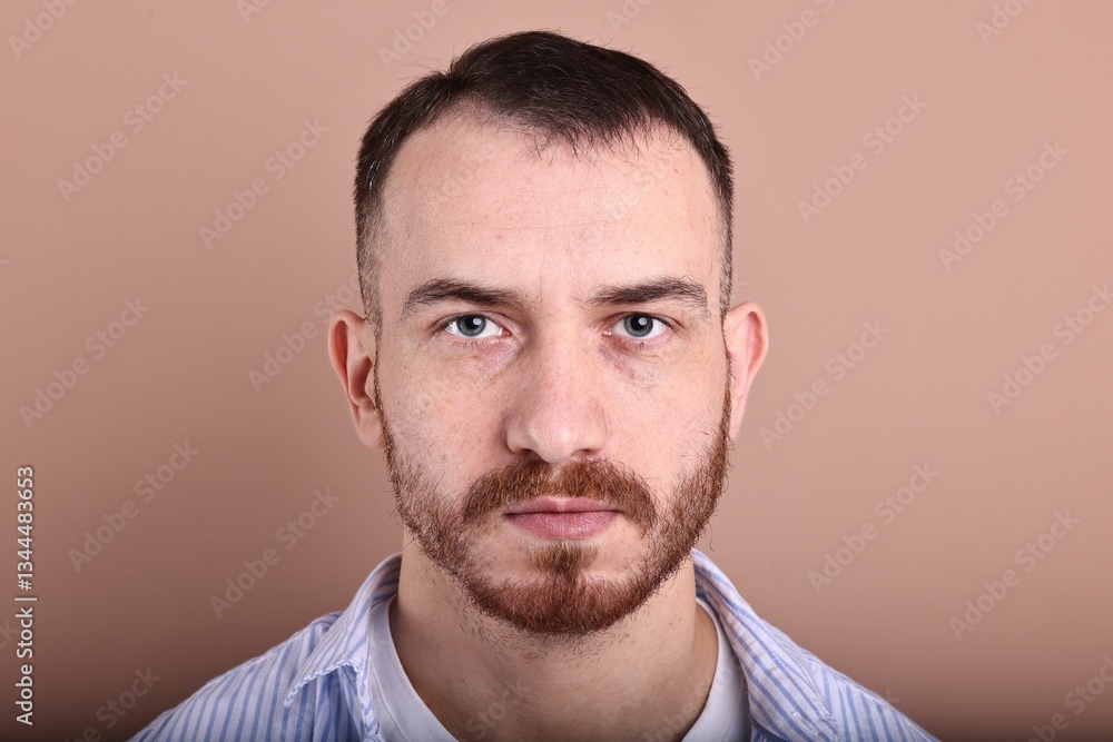 Obraz premium Baldness problem. Man with receding hairline on dark beige background