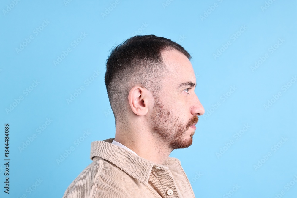Obraz premium Baldness problem. Man with receding hairline on light blue background