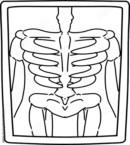 hand drawn xray