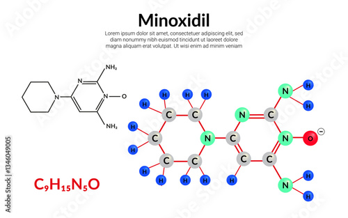 Minoxidil, medication for high blood pressure and hair loss treatment, molecular structure formula, ball-and-stick model, suitable for education or chemistry science content. Vector illustration