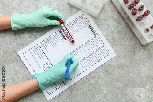 Doctor with HIV blood test ...