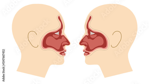 Vivid Medical Illustration: Normal Versus Deviated Nasal Septum in Human Heads, Cross-Section View. Nasal Obstruction, Breathing Problems, Sinusitis, Surgical Correction Explained.