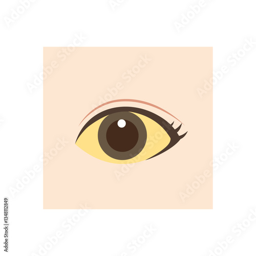 白目に黄疸が出ている目のイラスト