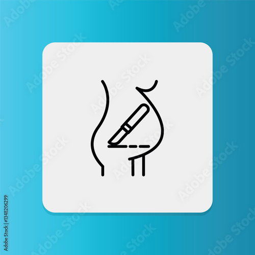 Cesarean Section icon. Editable stroke. Vector illustration