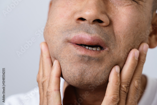 Foto The man has facial swelling due to an allergic reaction to triggers such as insect bites stings