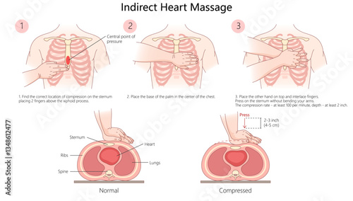 indirect heart massage CPR, showing proper hand placement, compression depth, and technique for effective chest compressions diagram hand drawn vector illustration. Medical science educational