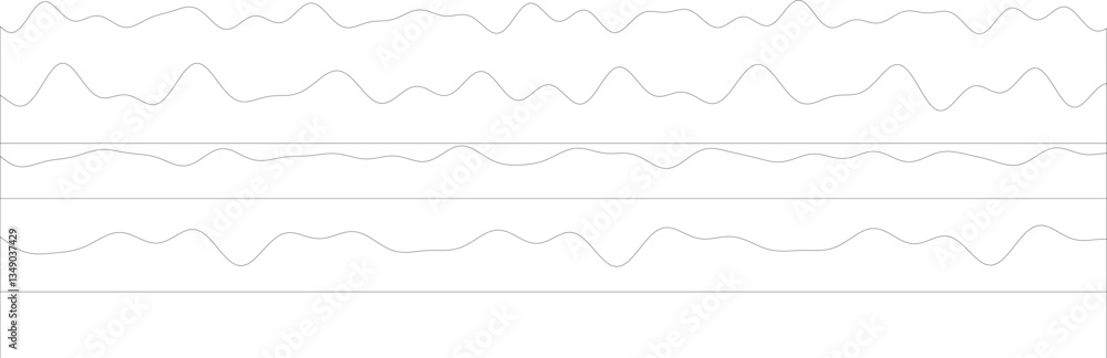 Complex brainwave activity displayed in eeg graph. Complex brainwave activity displayed in eeg graph.