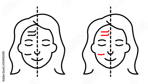 Facelifting procedure icons pack. vector illustrations designs