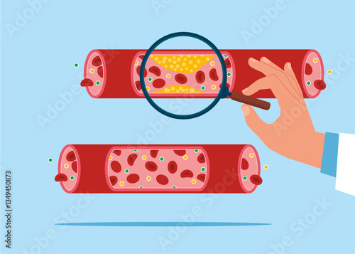 Studying blood vessels and veins from cholesterol and blood cells clot. Cardiovascular system, cardiology, medical examination topics. Flat vector illustration