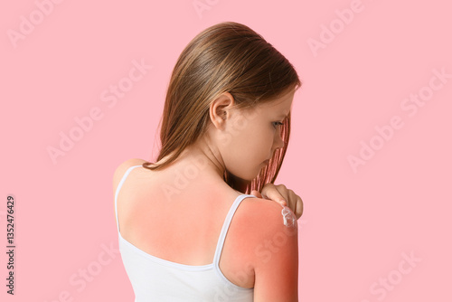 Little girl with red sunbur...