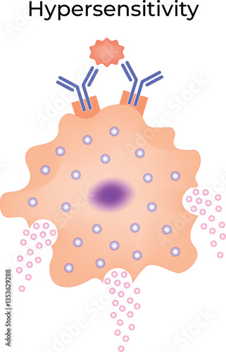 Hypersensitivity Reaction Vector Illustration