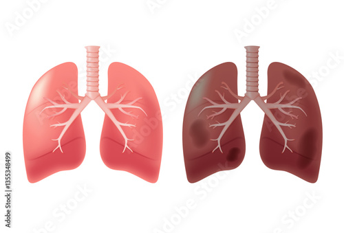 Healthy lungs and disease lungs on white isolate. Autopsy medical concept. Cancer and smoking problem. Human lungs 3D illustration. Internal organs isolated medical concept, healthcare, healthy