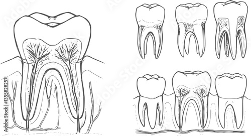 Teeth sketch. Hand drawn different types of human tooth collection. Dentist graphic template. Engraving fangs and molars. Dental oral care. Toothache treatment. Vector stomatology set
