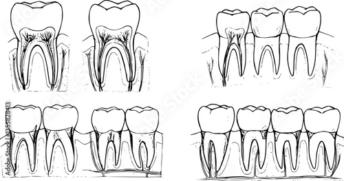 Teeth sketch. Hand drawn different types of human tooth collection. Dentist graphic template. Engraving fangs and molars. Dental oral care. Toothache treatment. Vector stomatology set