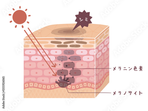肌の断面図で見るシミが出来る図解イラスト