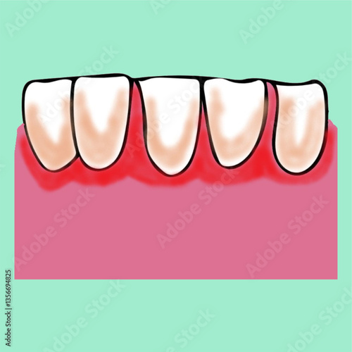 peridontotitis gum disease dental problem dentist