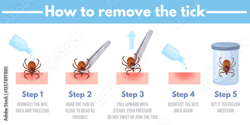 Tick removal. How to remove ticks insect infographics banner, mite bug animal human acarid bite prevention safety protection, tweezers parasite extraction neat vector illustration