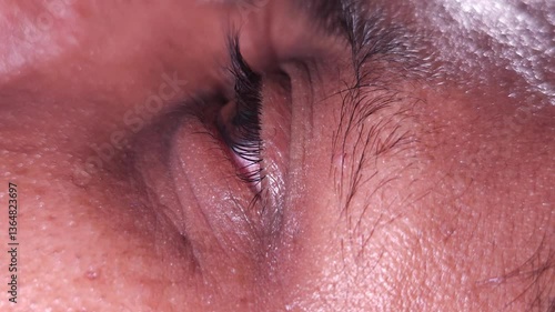 Ophthalmologist carefully applies eye drops to patient's eyes Closeup