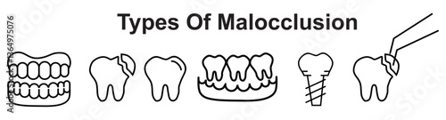 types of malocclusion, including spacing, overcrowding, crossbite, overbite, underbite, and open bite diagram hand drawn schematic raster illustration. Medical science educational illustration 