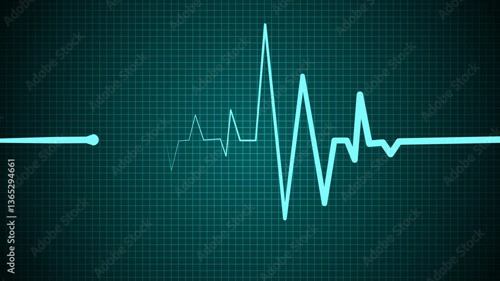 ECG Heartbeat Line on Grid Background, Electrocardiogram (ECG) line on a dark grid background, representing heart activity ECG Heartbeat Line on Grid Background, Electrocardiogram (ECG) line on a dark grid background, representing heart activity
