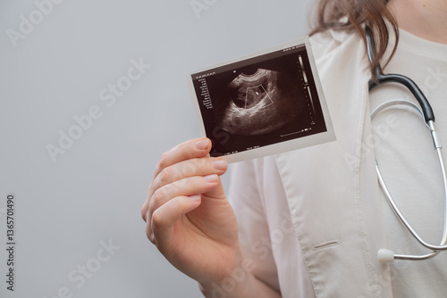 Photos Female obstetrician holds ultrasound image, advising on reproductive health and family planning
