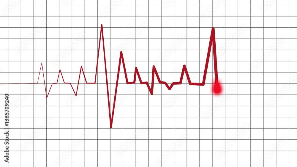 ECG Heartbeat with Flatline and Spike Animation, A electrocardiogram ECG line on a dark grid background, showing a heartbeat pattern with a flatline ECG Heartbeat with Flatline and Spike Animation, A electrocardiogram ECG line on a dark grid background, showing a heartbeat pattern with a flatline
