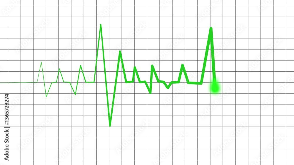 ECG Heartbeat with Flatline and Spike Animation, A electrocardiogram ECG line on a dark grid background, showing a heartbeat pattern with a flatline ECG Heartbeat with Flatline and Spike Animation, A electrocardiogram ECG line on a dark grid background, showing a heartbeat pattern with a flatline