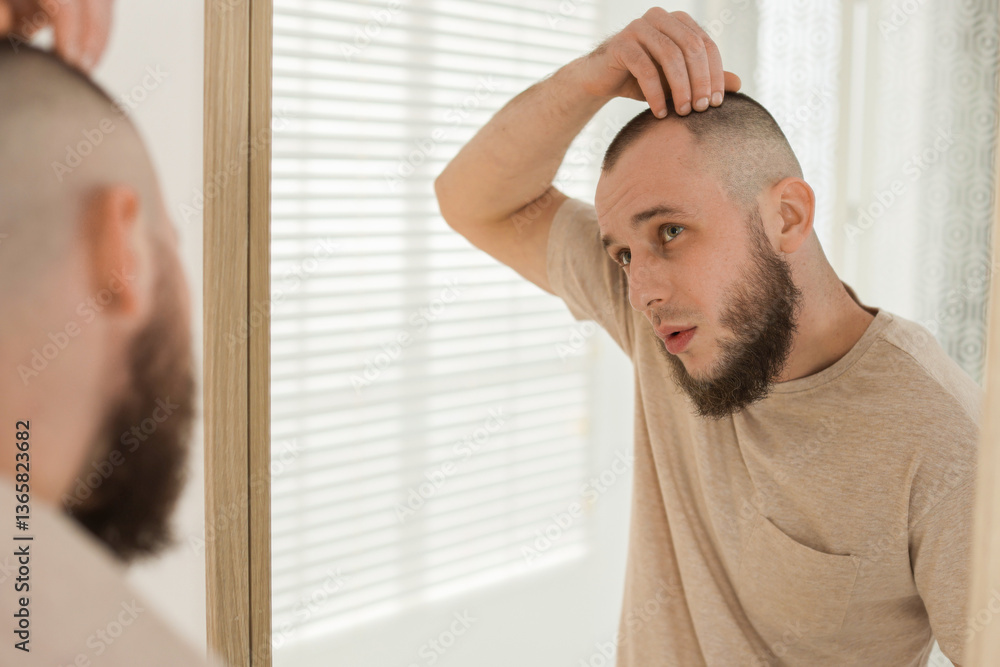 Obraz premium Baldness problem. Man with receding hairline near mirror at home