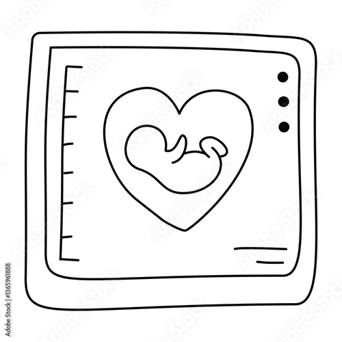 Doodle illustration ultrasound pregnancy.