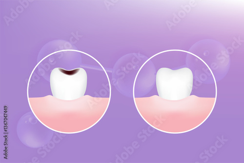 Teeth and gum care solutions ad, purple collagen with cosmetic advertising background ready to use, illustration vector.