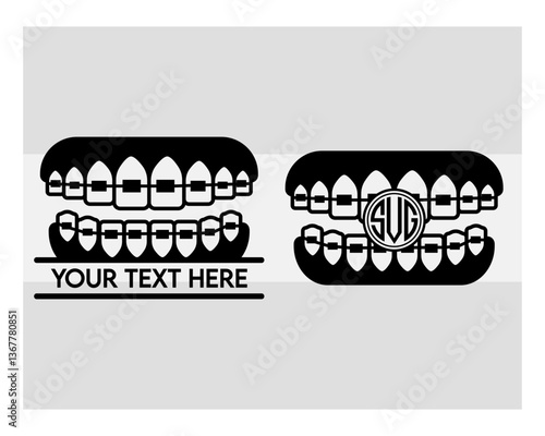 Fake Braces, Fake Braces Kit, Fake Braces Clip On, Braces Svg, Dental Braces For Kids, Braces Clipart, Teeth Svg, Braces Silhouette, Dentist, Dental Hygienist, Braces Outline, Eps, Cut file