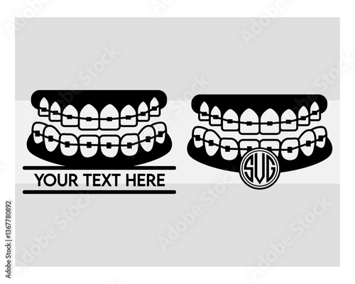 Fake Braces, Fake Braces Kit, Fake Braces Clip On, Braces Svg, Dental Braces For Kids, Braces Clipart, Teeth Svg, Braces Silhouette, Dentist, Dental Hygienist, Braces Outline, Eps, Cut file