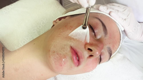 Professional beautician applying glycolic acid peel on face of beautiful young woman. Chemical peeling and beauty treatment concept.