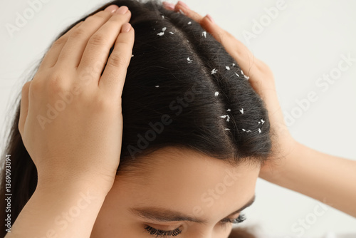 Young woman with dandruff p...