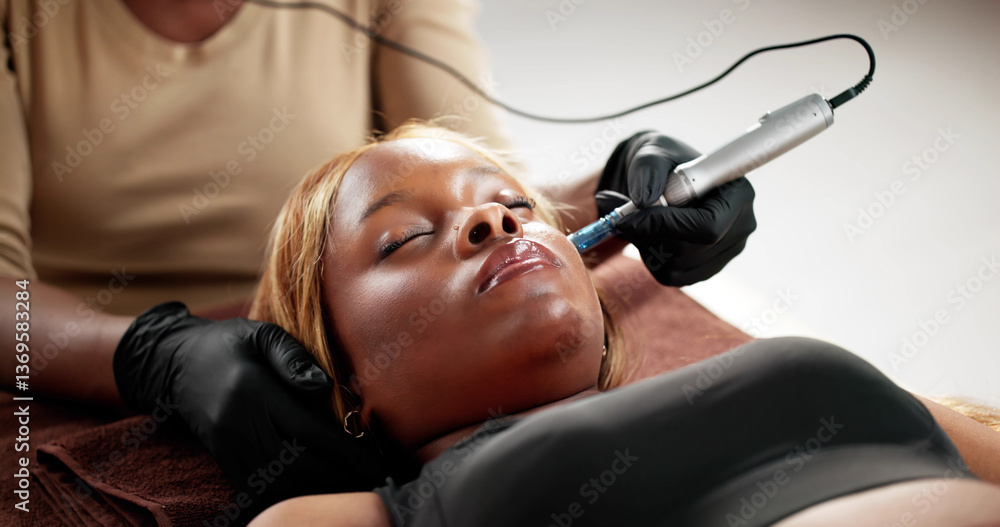 Skin Microneedling in Beauty Clinic
