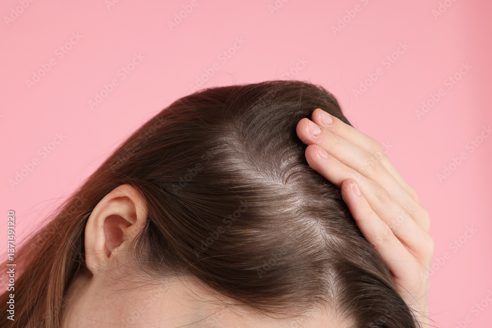 Fototapeta premium Girl with hair loss problem on pink background, closeup