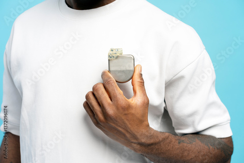 Photography Patient showing pacemaker device implanted in chest closeup