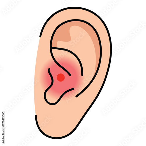 earache ear pain inflammation vertigo disease flat color vector illustration template design