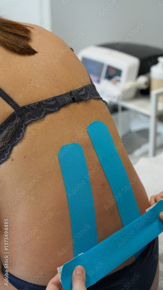 Close-up of a physiotherapist using therapeutic patches on a woman’s back for pain treatment