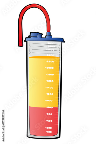 Vaser Liposuction System with Drainage Bottle