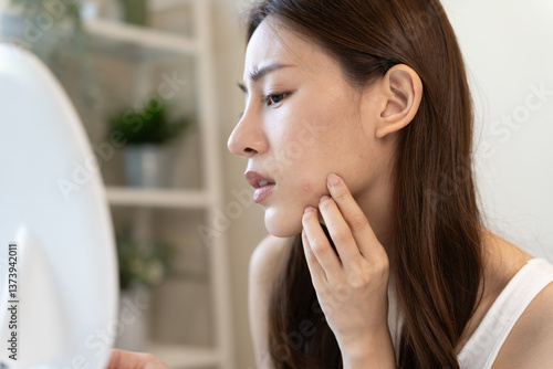 Bild auf Leinwand Woman worried about face Dermatology, rosacea dermatitis, allergic steroids, sensitive skin, red face from sunburn, acne, dry skin, large pores ,rash face, dull, freckles, wrinkle, skin problem,