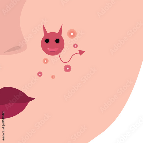 Young girl has skin problems with acne or allergic pimples on her face. Skincare and dermatology concept. Flat style vector illustration.